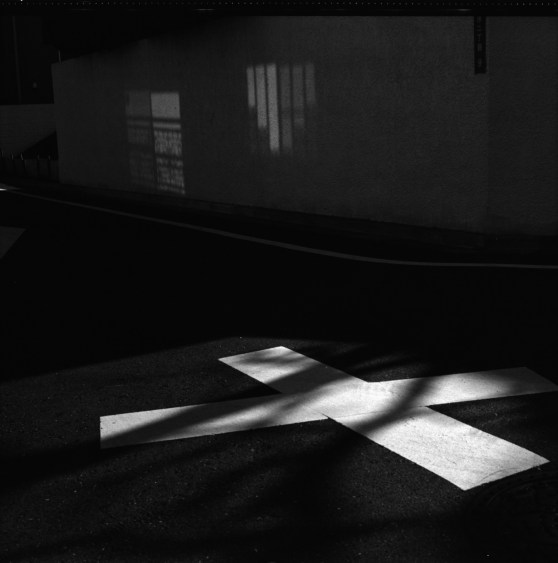 normal development 1:4